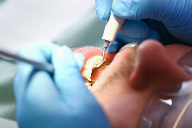 Best Weekend Emergency Dentist in Hoschton, GA