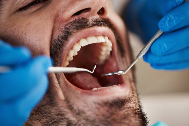 Best Emergency Tooth Extraction in Hoschton, GA